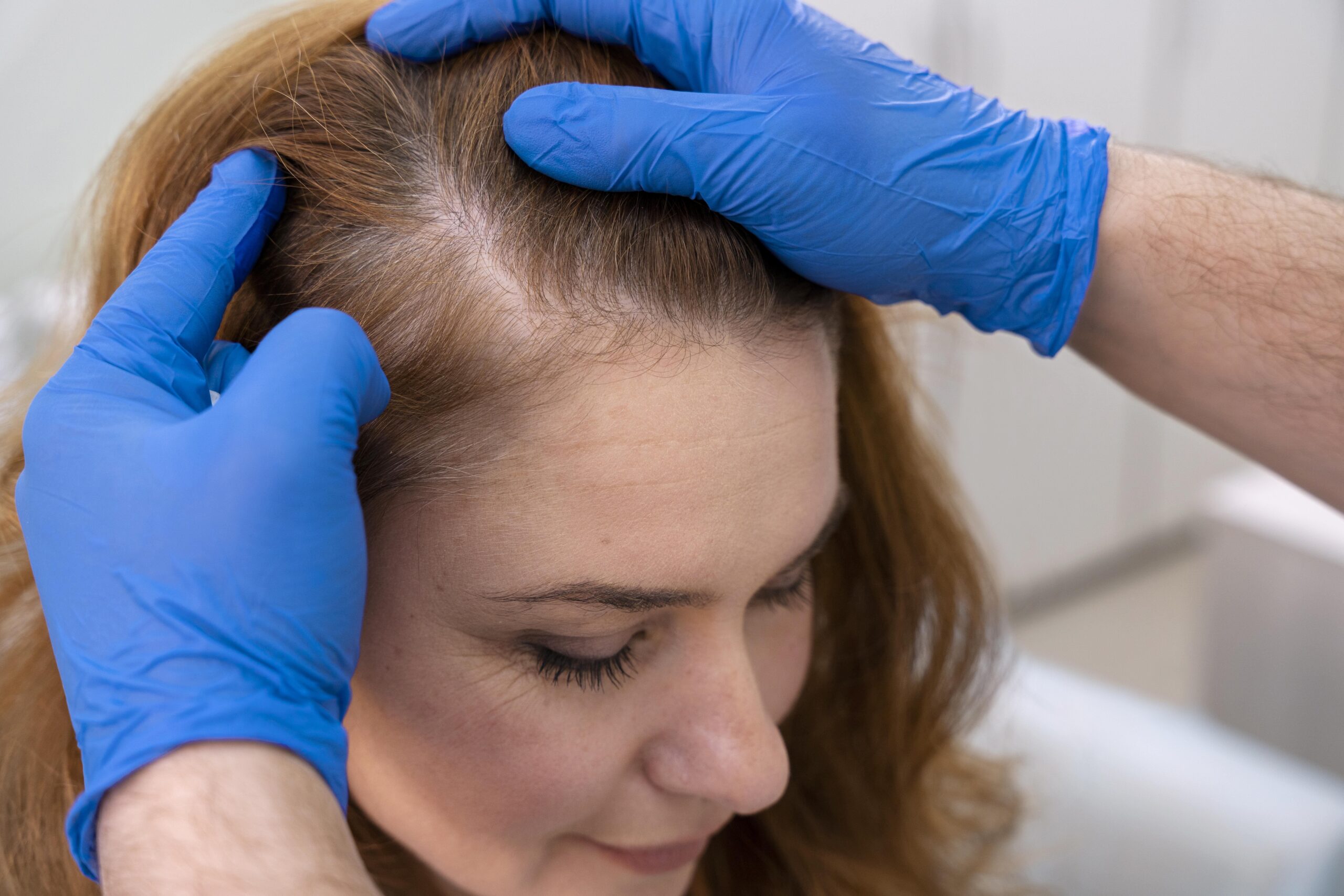 woman-getting-hair-loss-treatment-clinic (1)